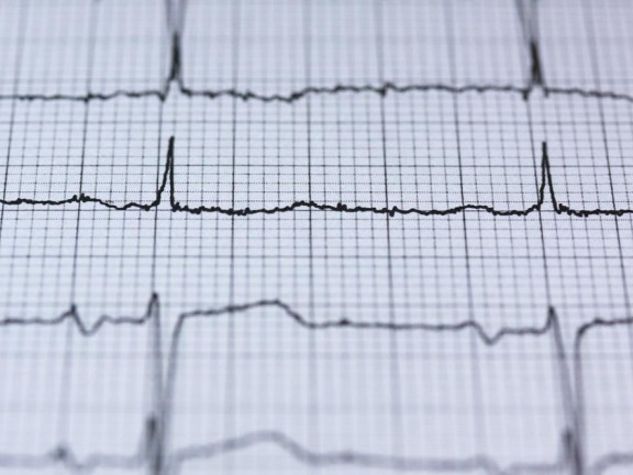 Vitals graph